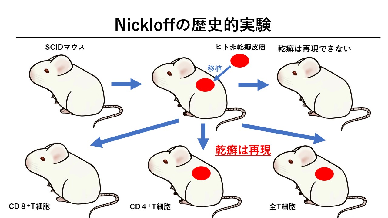 乾癬について(5) Nickoloffの歴史的実験その2 | 医療法人翠真会